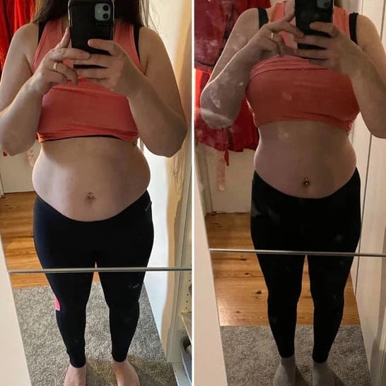 Before/after Sandrine D. — 3 weeks with Lyphéa